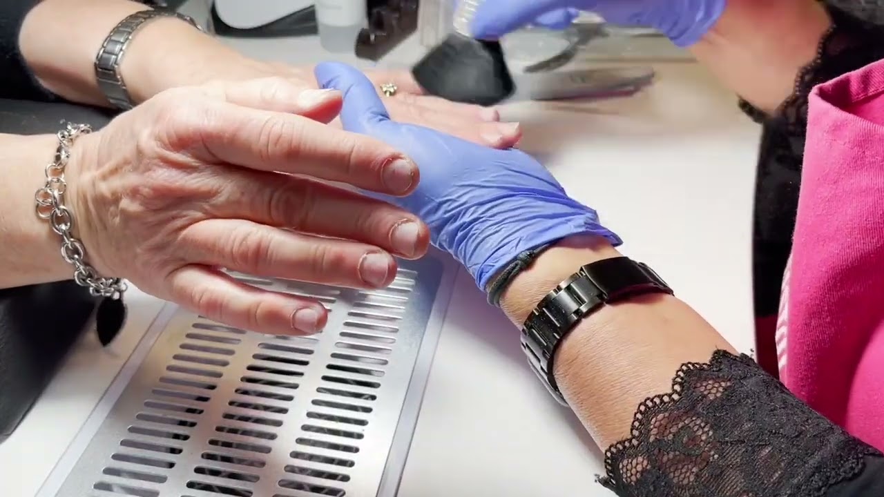 Ricostruzione Tip in gel: primo step