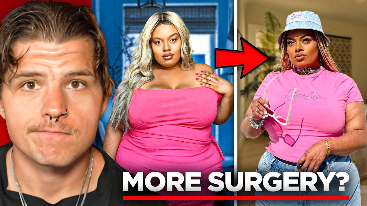 Stella Williams' Body Dysmorphia & Tummy Tuck