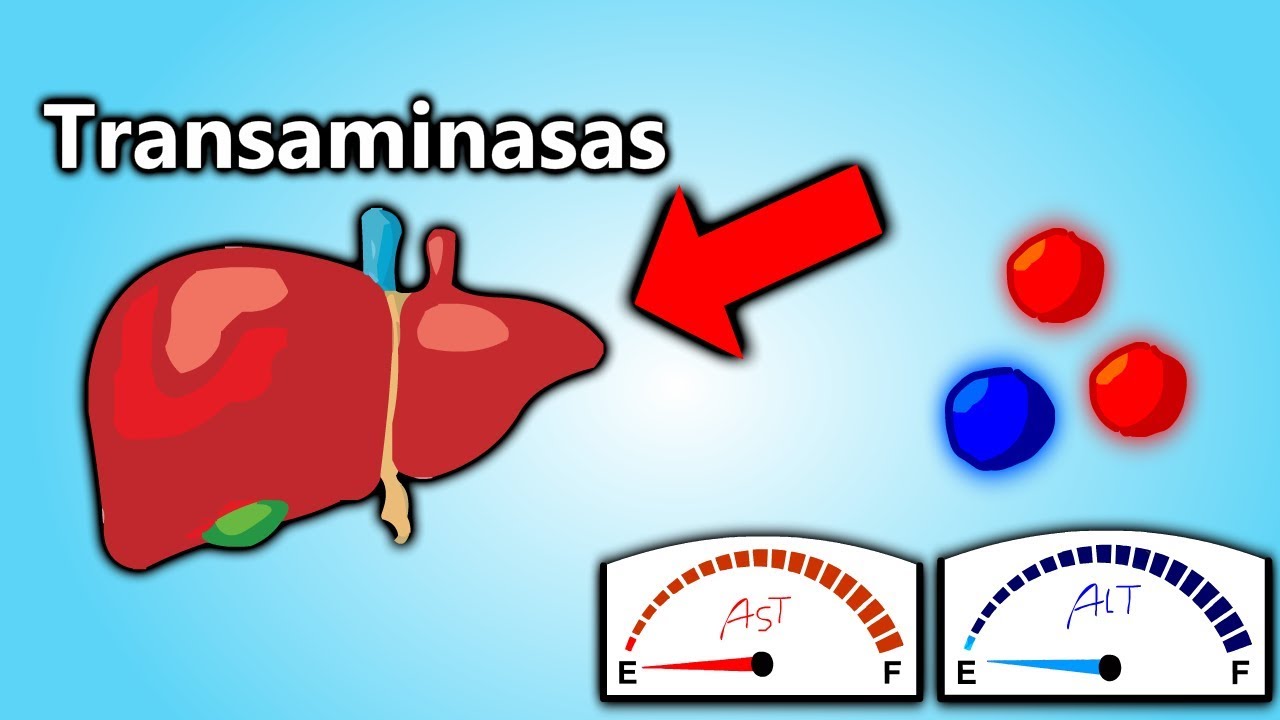 Transaminasas Altas, EXPLICACIÓN EN 5 MINUTOS!!!!  || Patología Clínica101