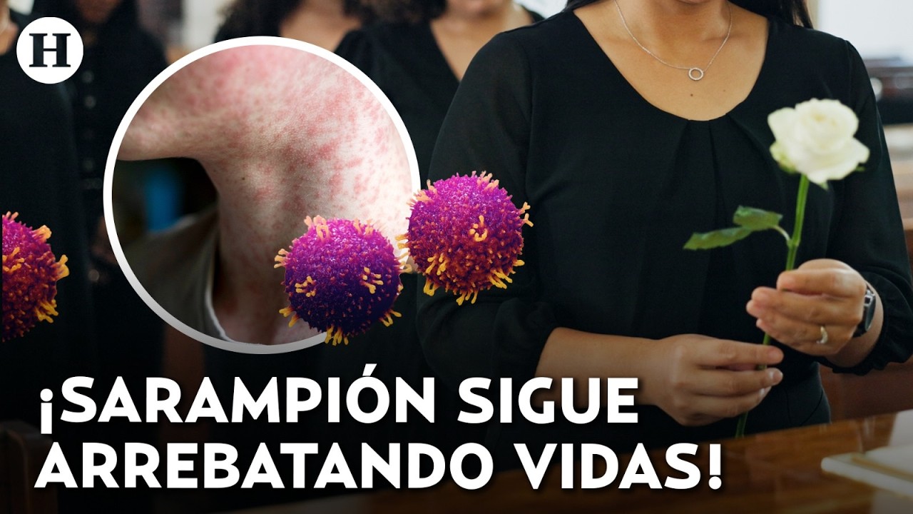 ¡Suman 31 muertos por el sarampión! México suma casi 10 mil casos desde 2025