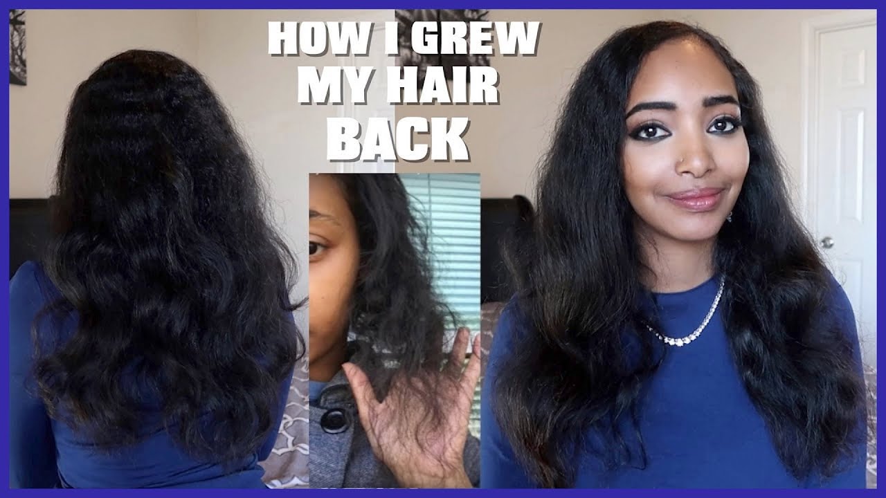 How To Grow Your Hair Back After Anemia Hair Loss (3 Years Update)