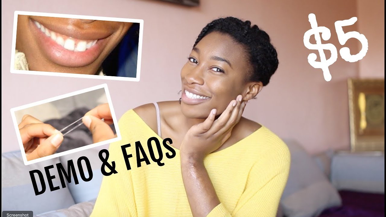 DEMO & FAQs: How To Close Your Gap with Rubber Bands