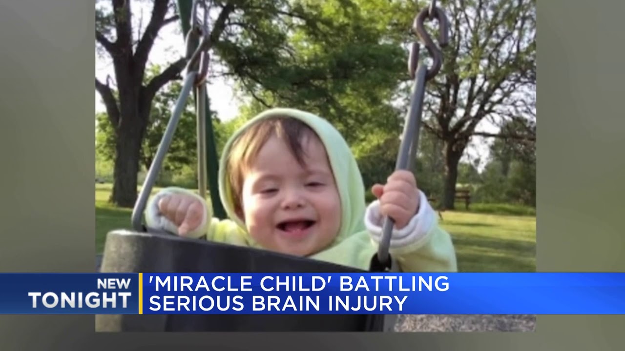 'Miracle child' battling serious brain injury