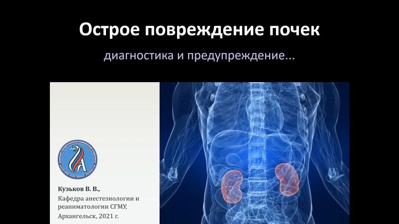 Острое повреждение почек и ХБП