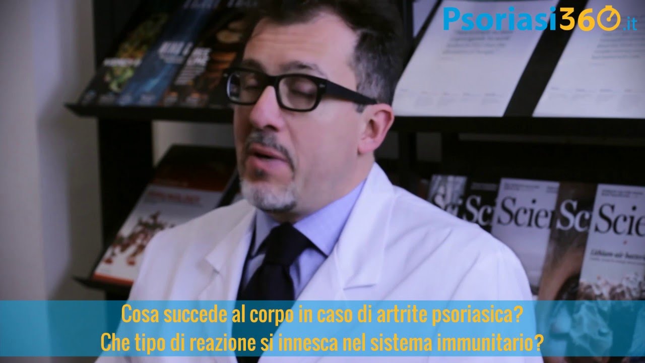 Artrite Psoriasica: come reagisce il sistema immunitario