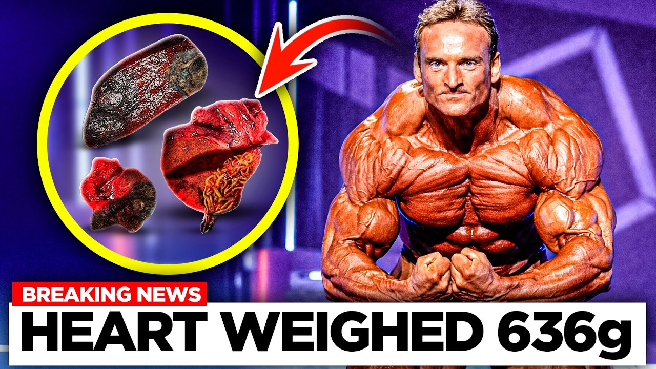How 0% Body Fat KILLED This Bodybuilder!
