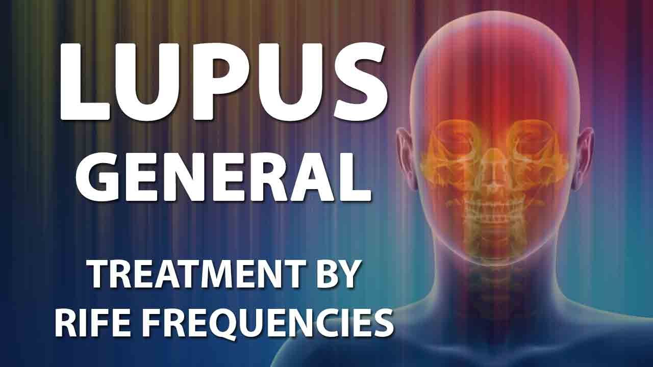Lupus (General) - RIFE Frequencies Treatment - Energy & Quantum Medicine with Bioresonance