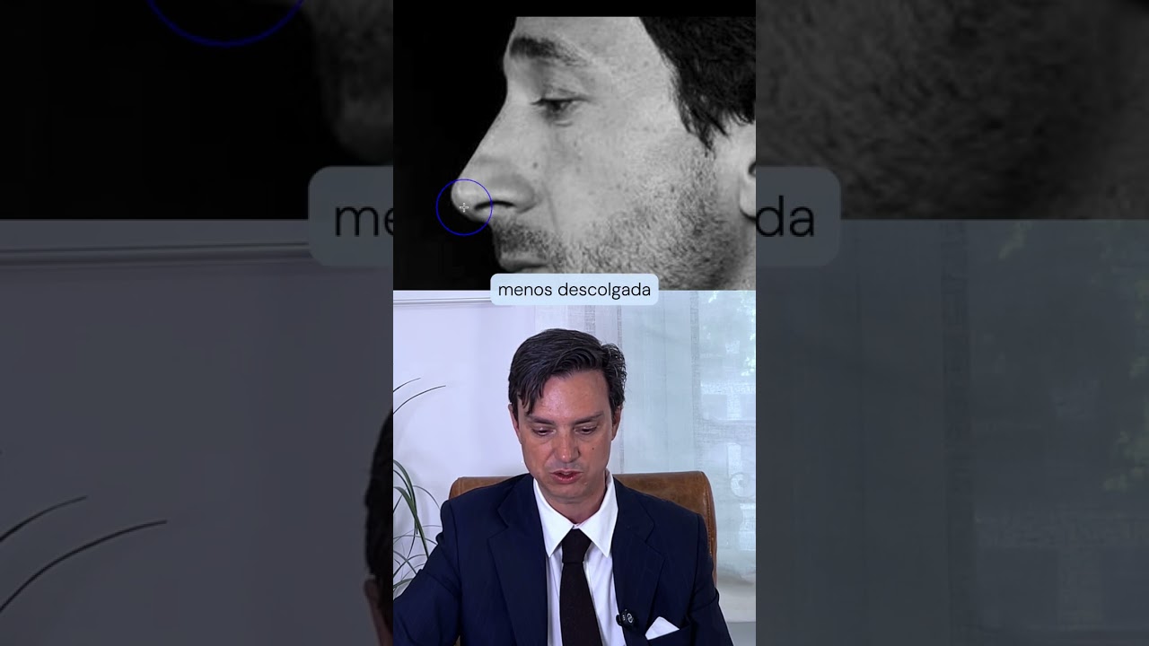 &iquest;C&oacute;mo se ver&iacute;a Adrien Brody tras una rinoplastia?