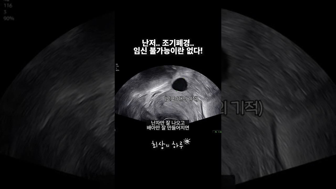 [브이로그] 임신.. 포기하지 않으면 기회는 꼭 옵니다! 반드시!!!