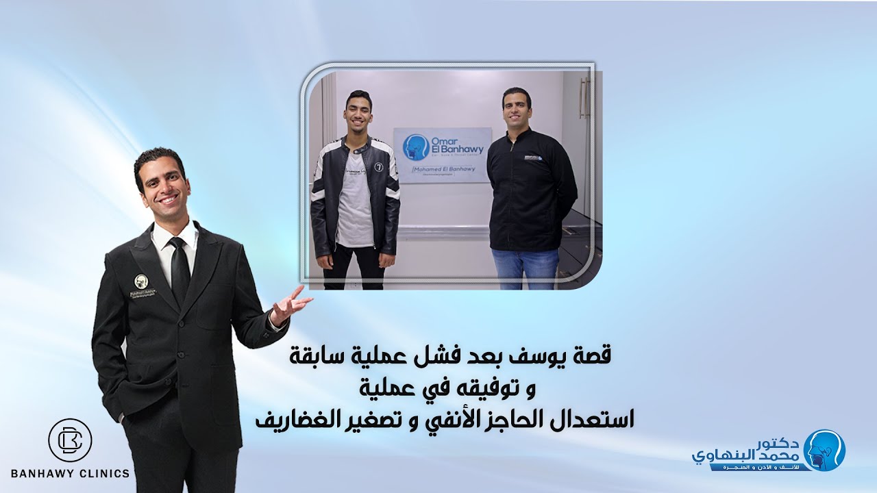قصة يوسف بعد فشل عملية سابقة وتم استعدال حاجز الأنفي و تصغير غضاريف