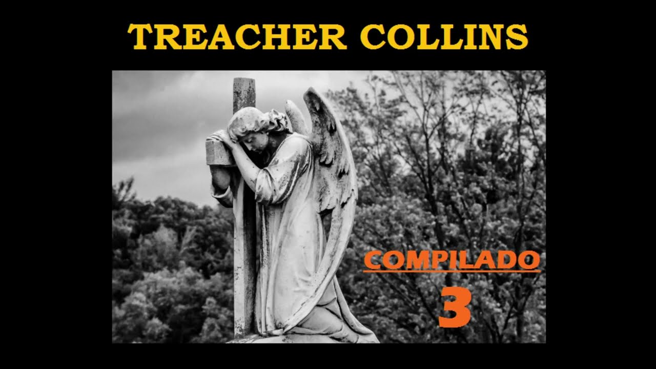 TREACHER COLLINS - Compilado 3 (AUDIO - 2024)