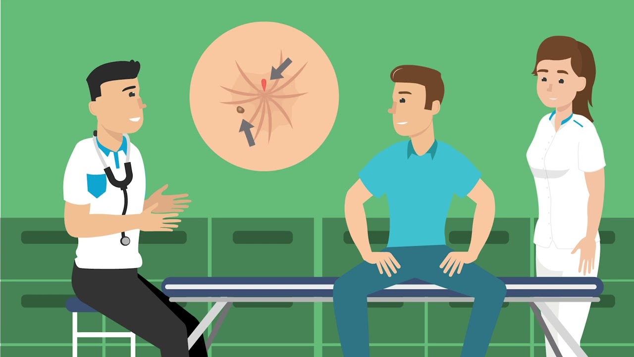 Proctoscopy - Research and treatment of hemorrhoids | Spaarne Gasthuis