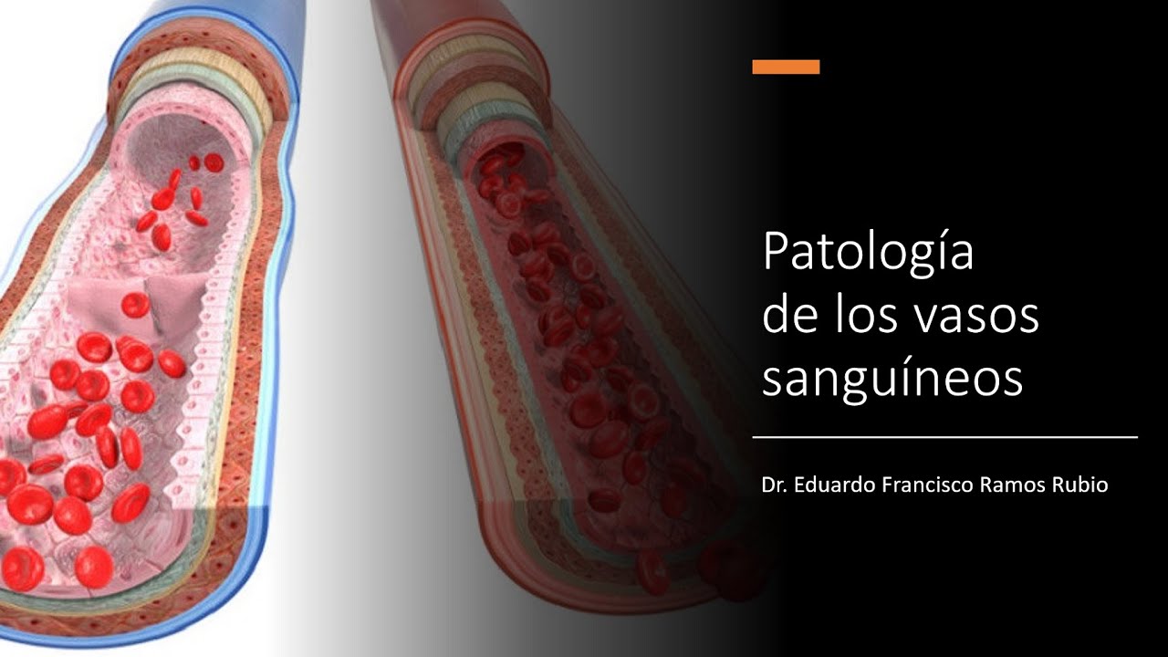 Patología de los vasos sanguíneos