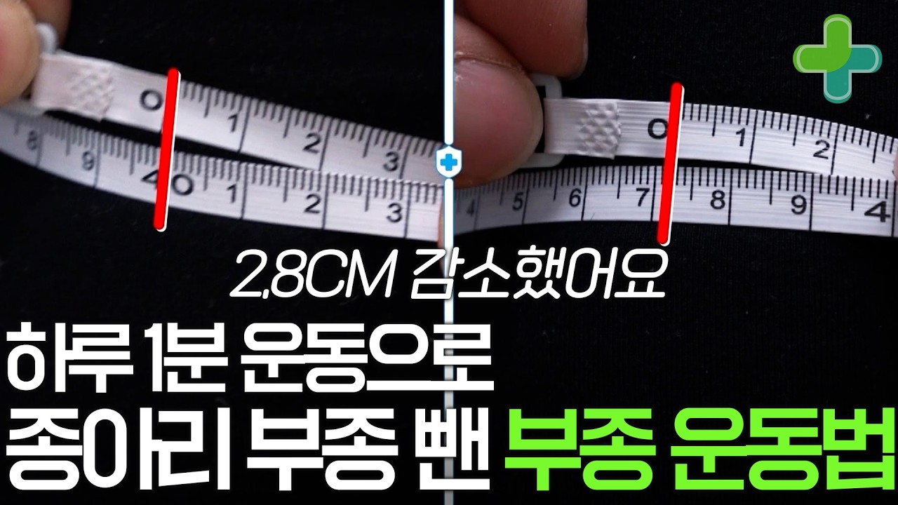절대로 안 빠지던 부종, 이렇게 해 보세요! 종아리 부종 없앤 하루 1분 운동법