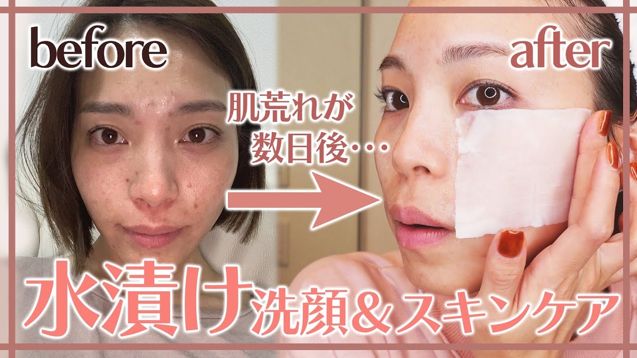 インスタで喜びの声が続々！今夜から自宅で出来る！肌荒れ沈静術