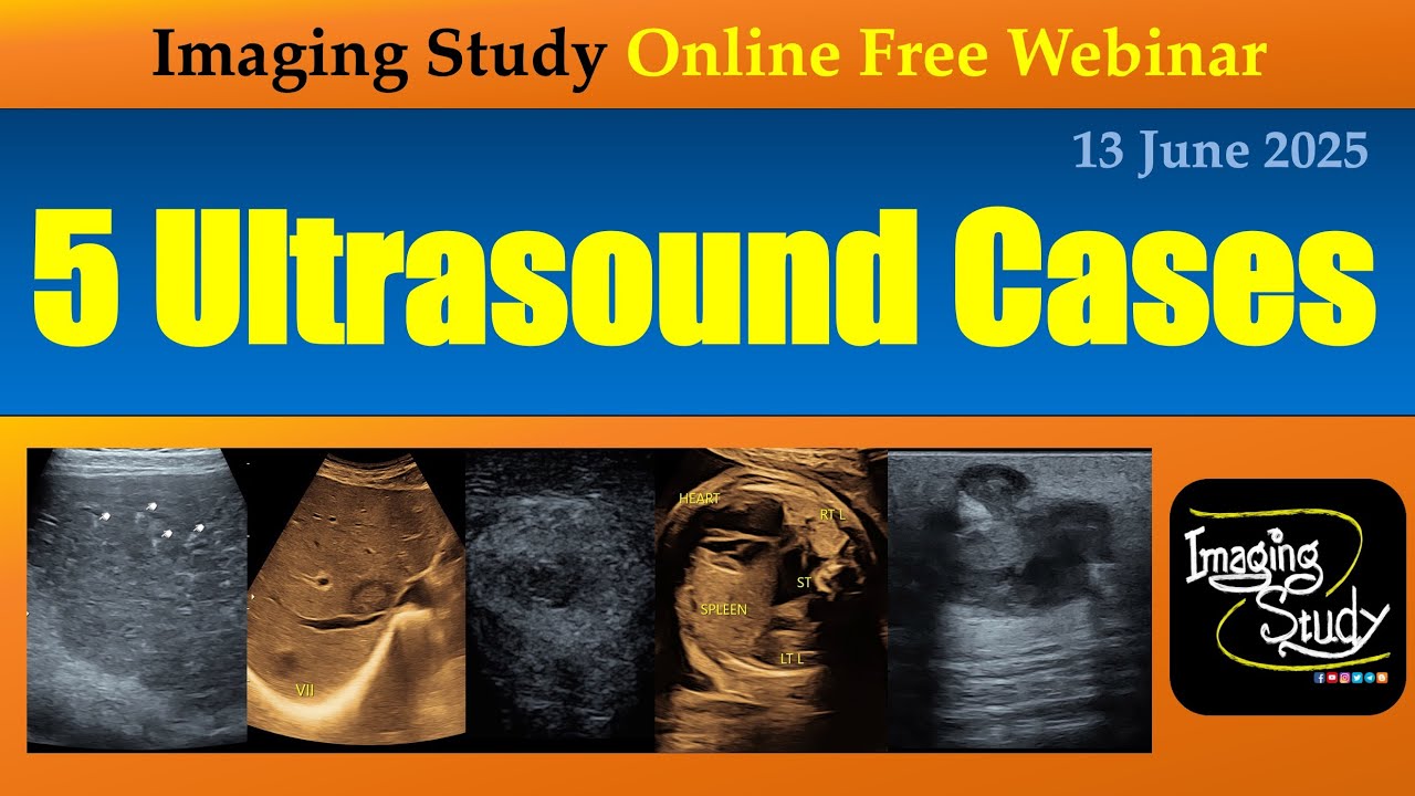 5 Ultrasound Cases || Imaging Study || 13 June 2025 || Online Webinar