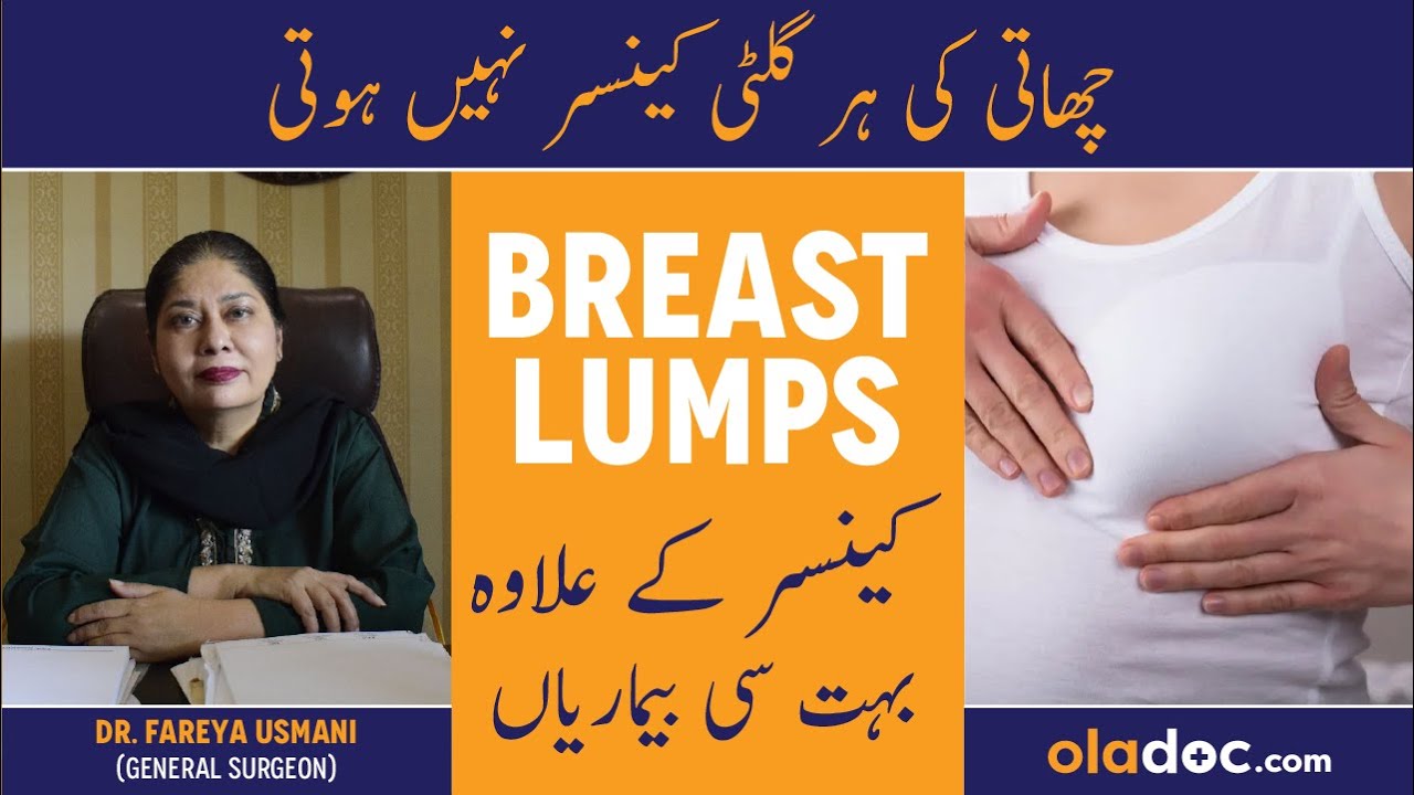 Breast Lump Symptoms Treatment In Urdu/Hindi - Chati Mein Guilty Ka Ilaj - Breast Lumps How To Know