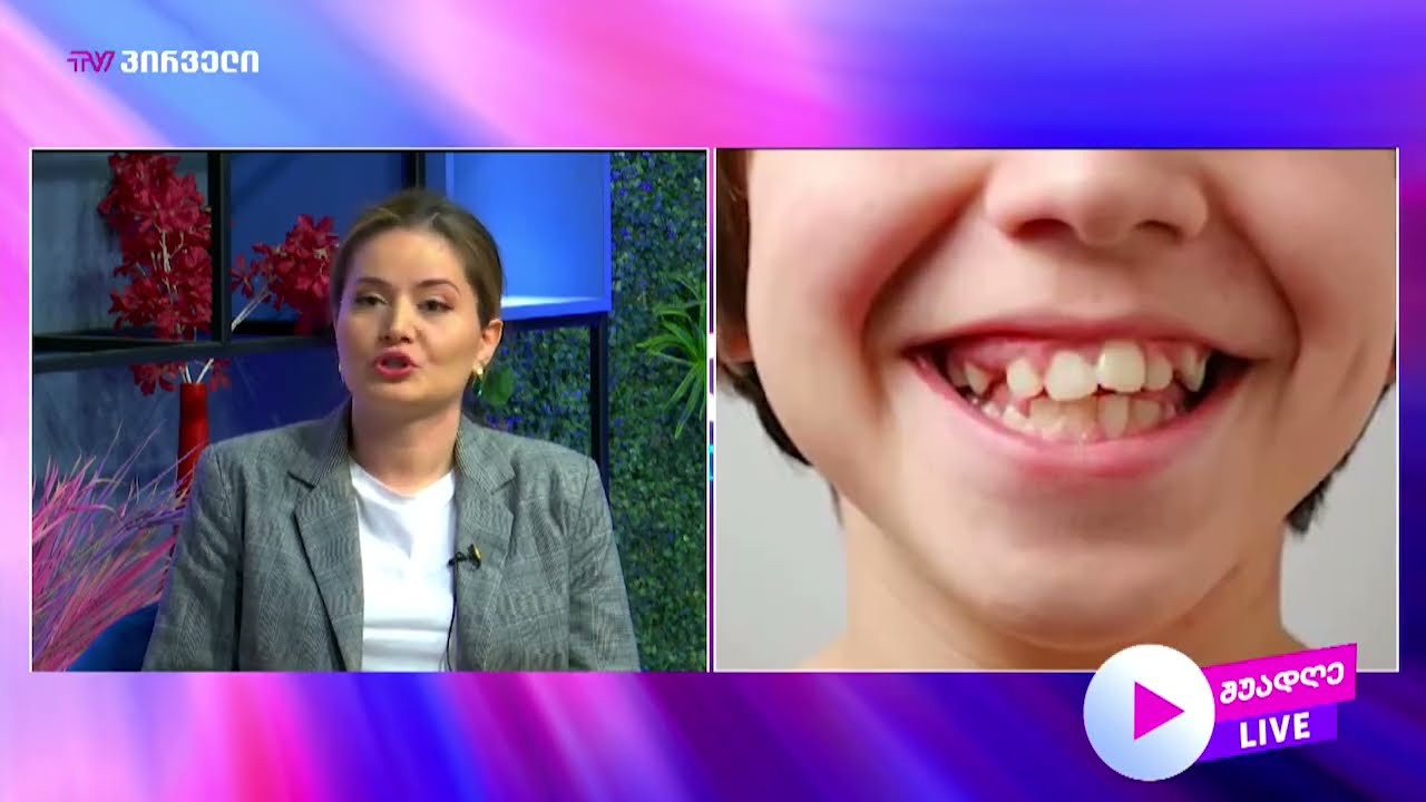 როდის არის რეკომენდებული სიბრძნის კბილების ამოღება და  ️რა მეთოდებია თანამედროვე სტომატოლოგიაში