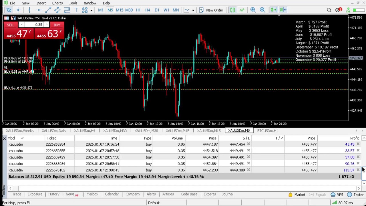 Live XAUUSD - Gold Trading - My Strategy - 07/01/2026 #gold, #xauusd, #btc, #livegoldtrading, #forex