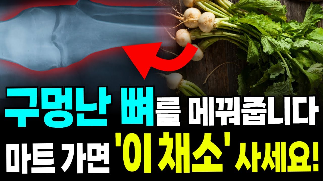 골다공증을 막으려면 '이 채소' 꼭 드세요! 구멍난 뼈가 채워집니다. 골밀도 높이는 음식 4가지와 생활 습관 운동법 총정리, 이외 채소 시리즈
