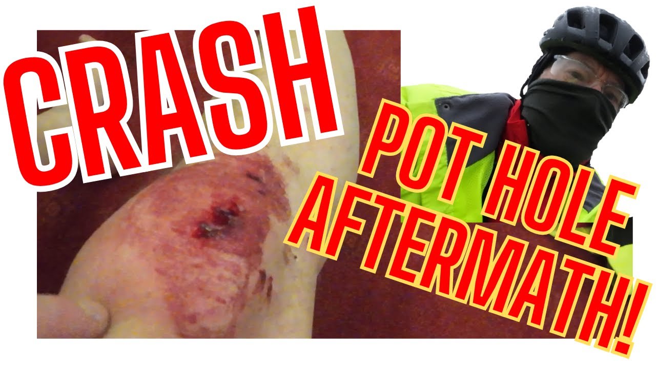100 hilly miles & bike crash in North Pennines.
