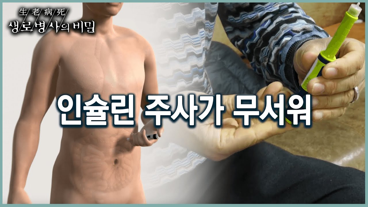 한국 당뇨병 환자들이 피하는 인슐린 주사의 필요성 (KBS 20220323 방송)