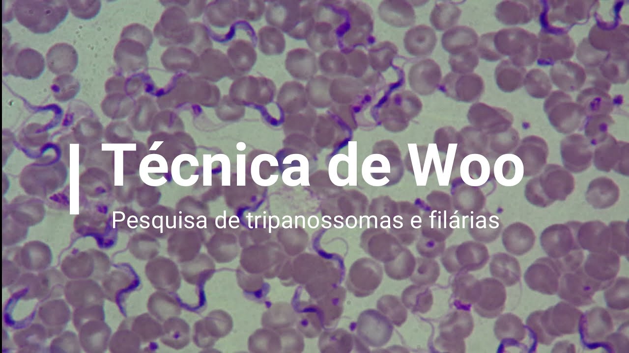 Técnica de Woo