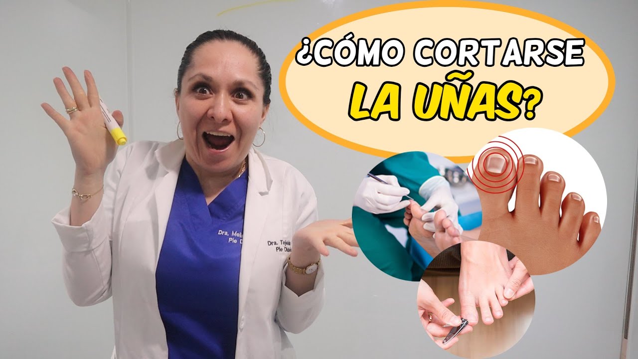 ¿las uñas se cortan redondas o cuadradas?  🟦😲🔵 /Dra. Melissa Tejeida