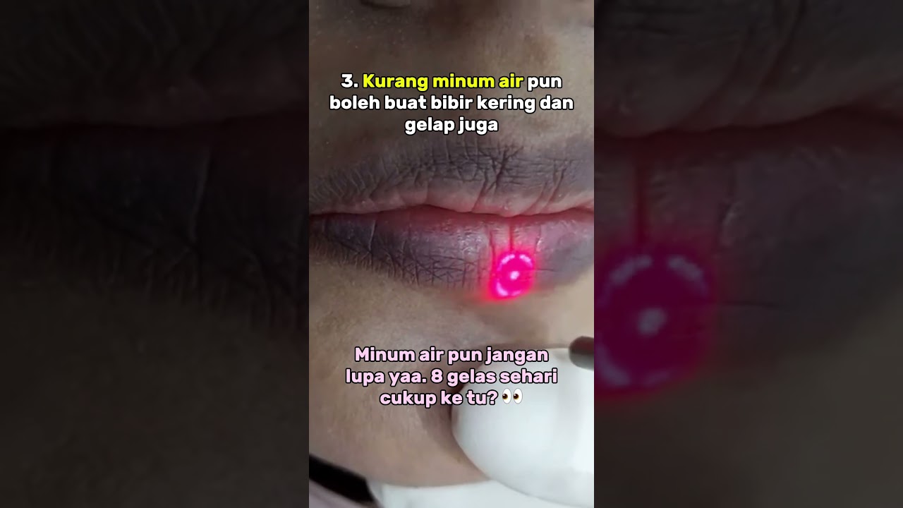 Punca bibir gelap dan solusinya! 