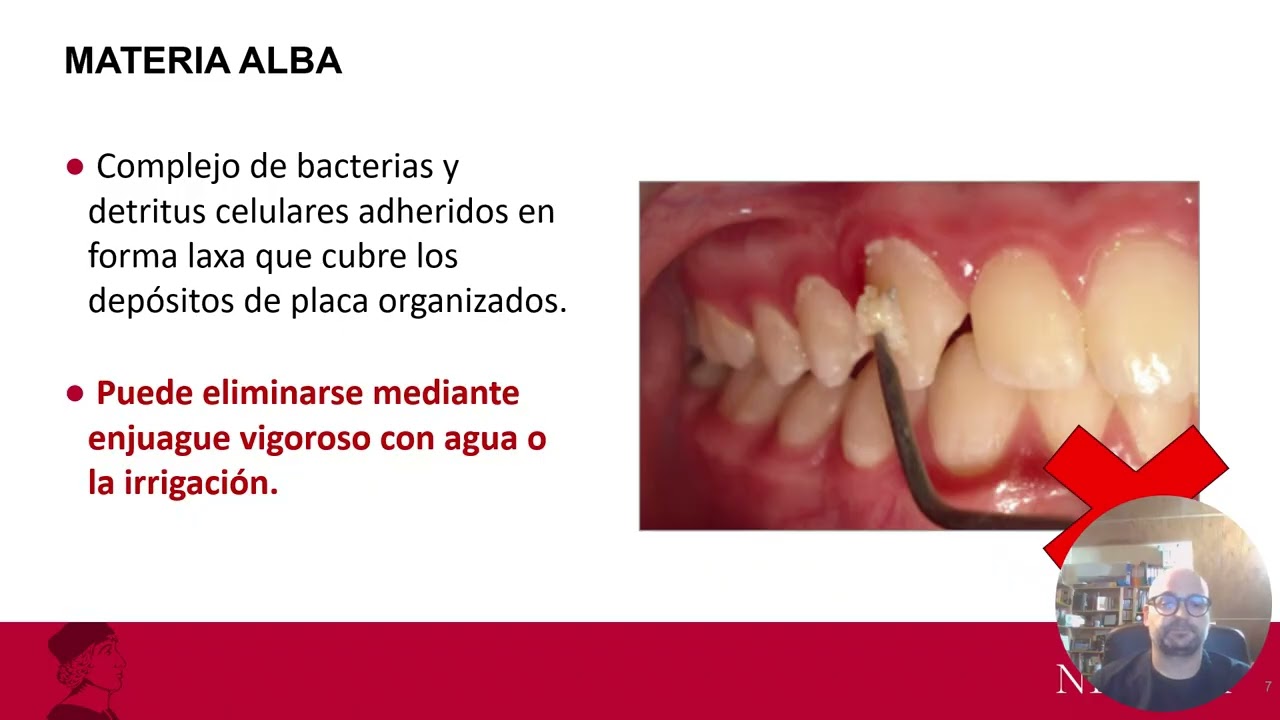 Microbioma, en Odontología. Biopeliculas.