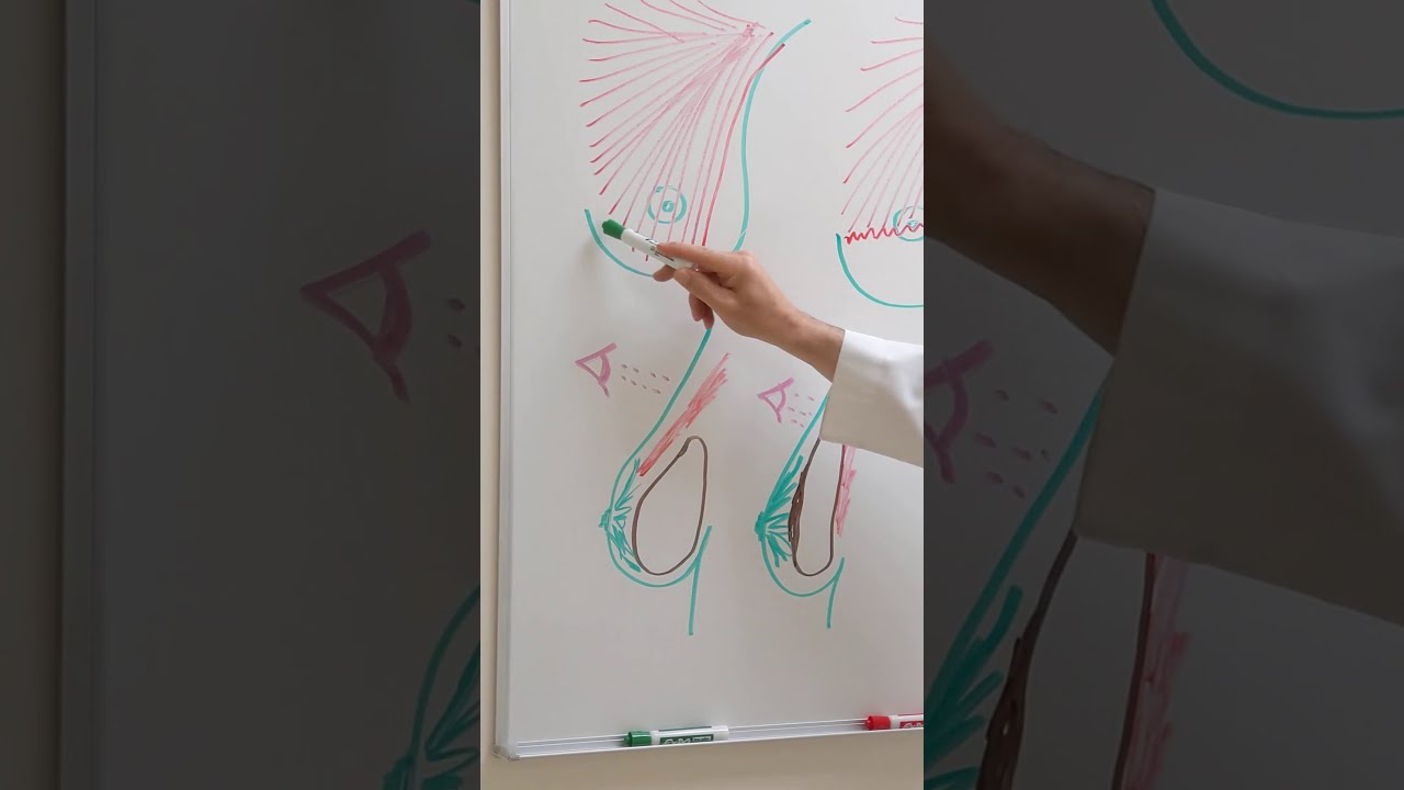 Увеличение груди — больше или меньше?