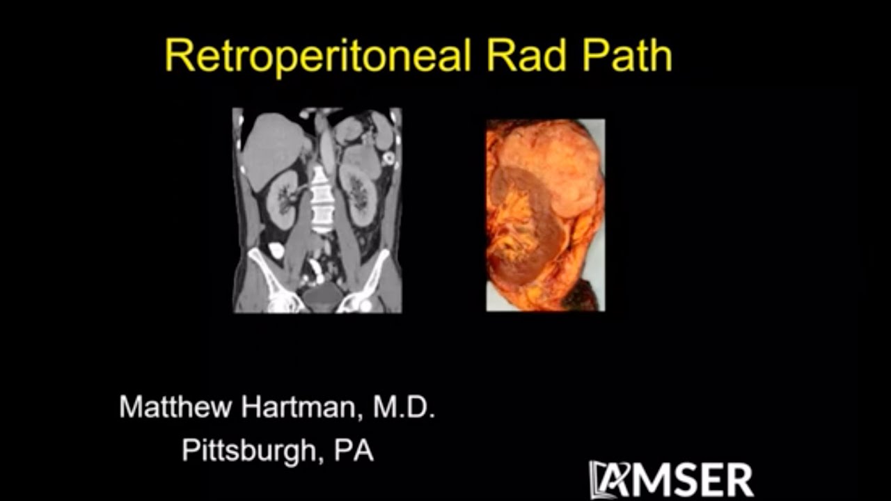 Retroperitoneal Rad Path