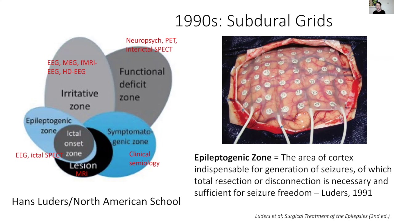 Intracranial EEG Patterns