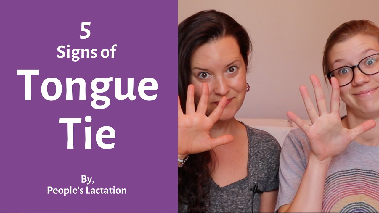 Tongue tie breastfeeding | 5 signs of a tongue tie baby | breastfeeding with tongue tie