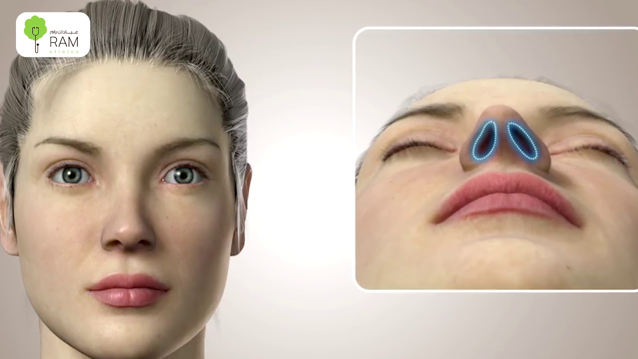 عمليات تجميل الانف مع الدكتور محمد متبولي - عيادات رام 920020011