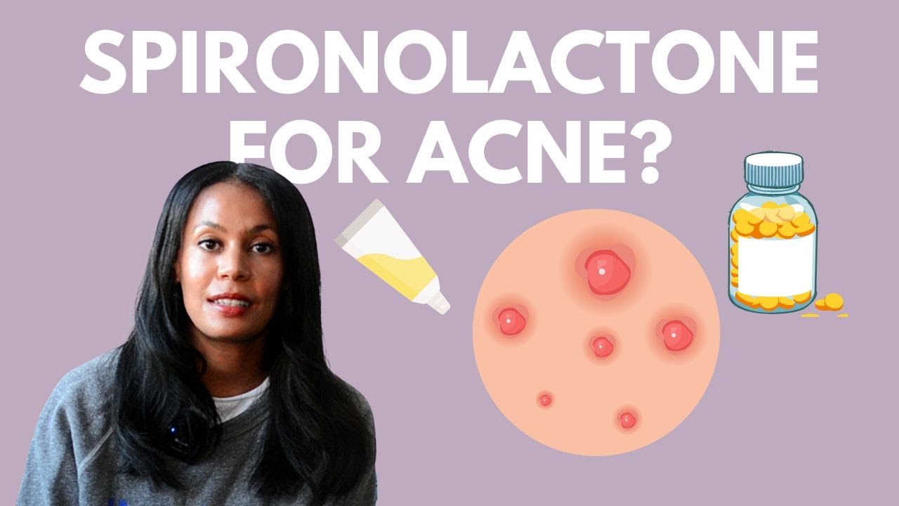 Spironolactone for Hormonal Acne, Does it Really Work?