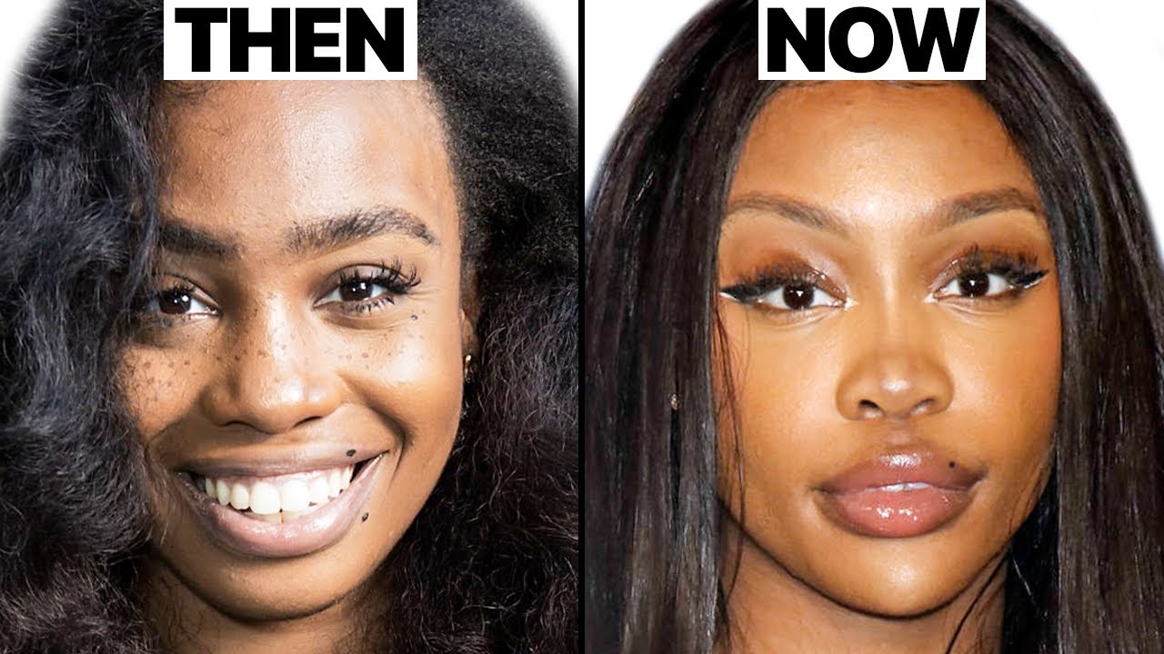 SZA New Face | Plastic Surgery Analysis