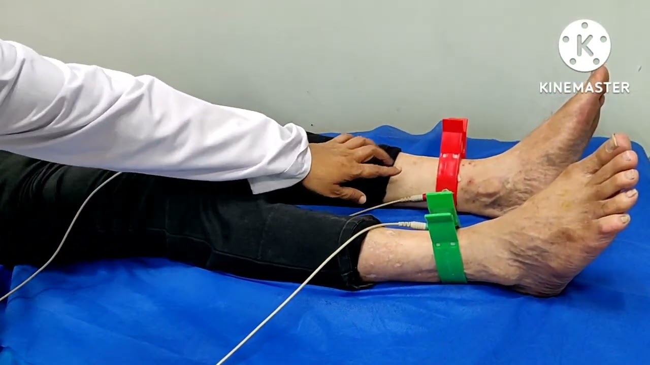 Complete ECG recording @ drseema kale