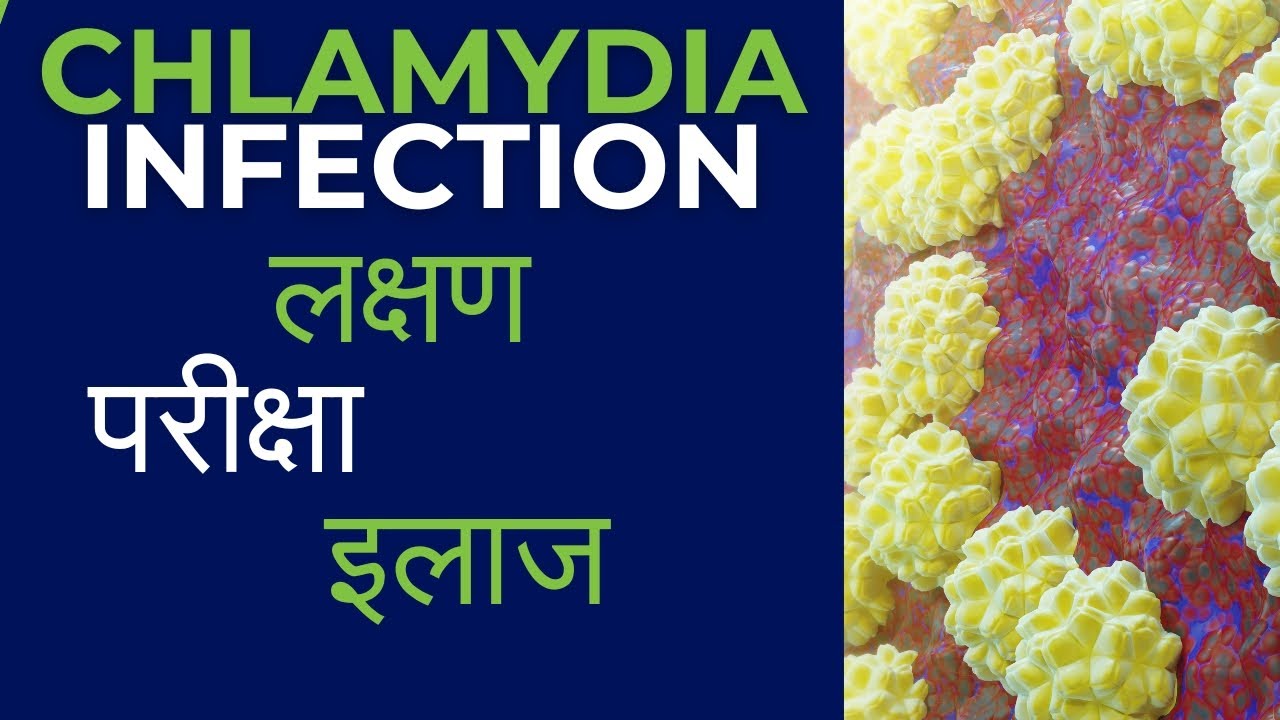 Chlamydia treatment in Hindi | Chlamydia kya hota hai | chlamydia infection symptoms, diagnosis