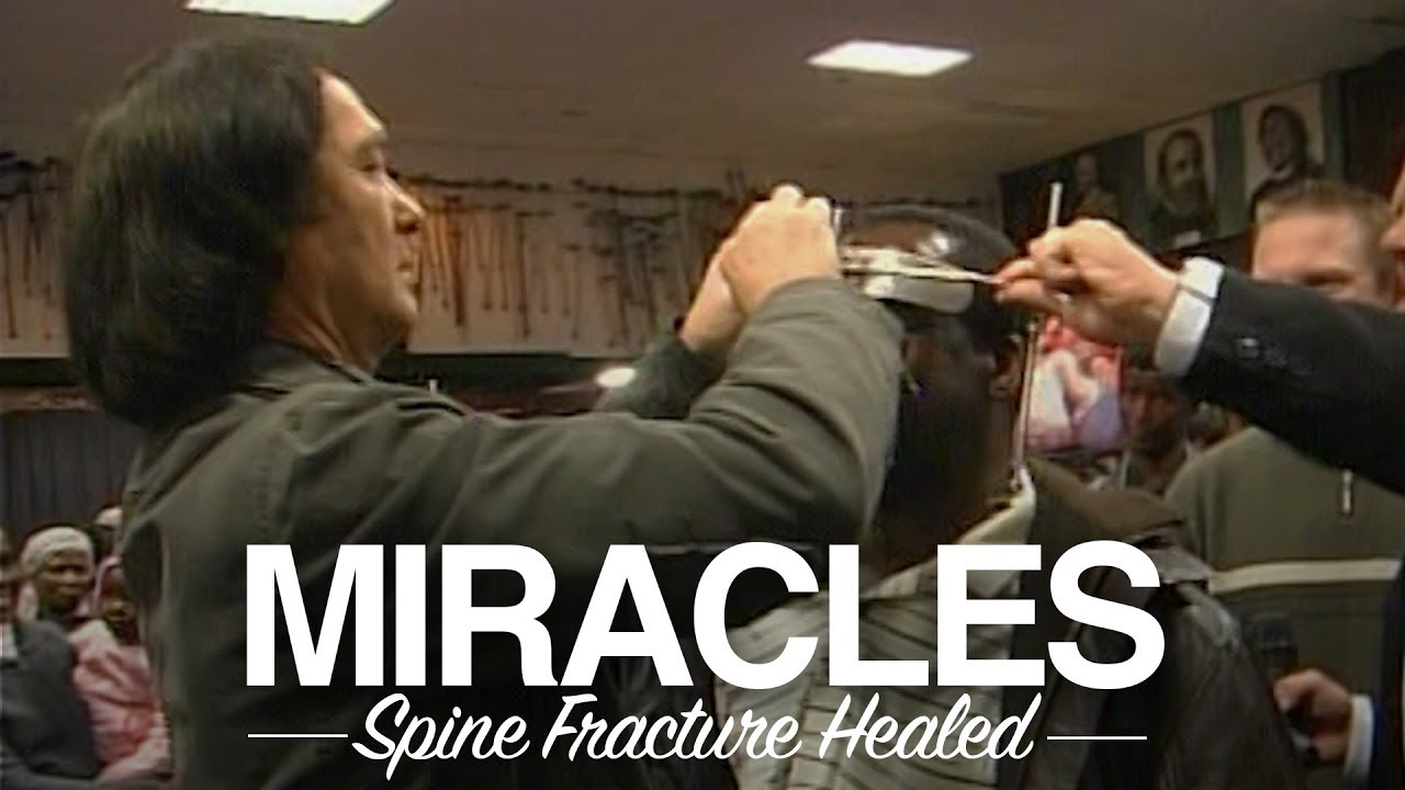 Spine Fracture Healed