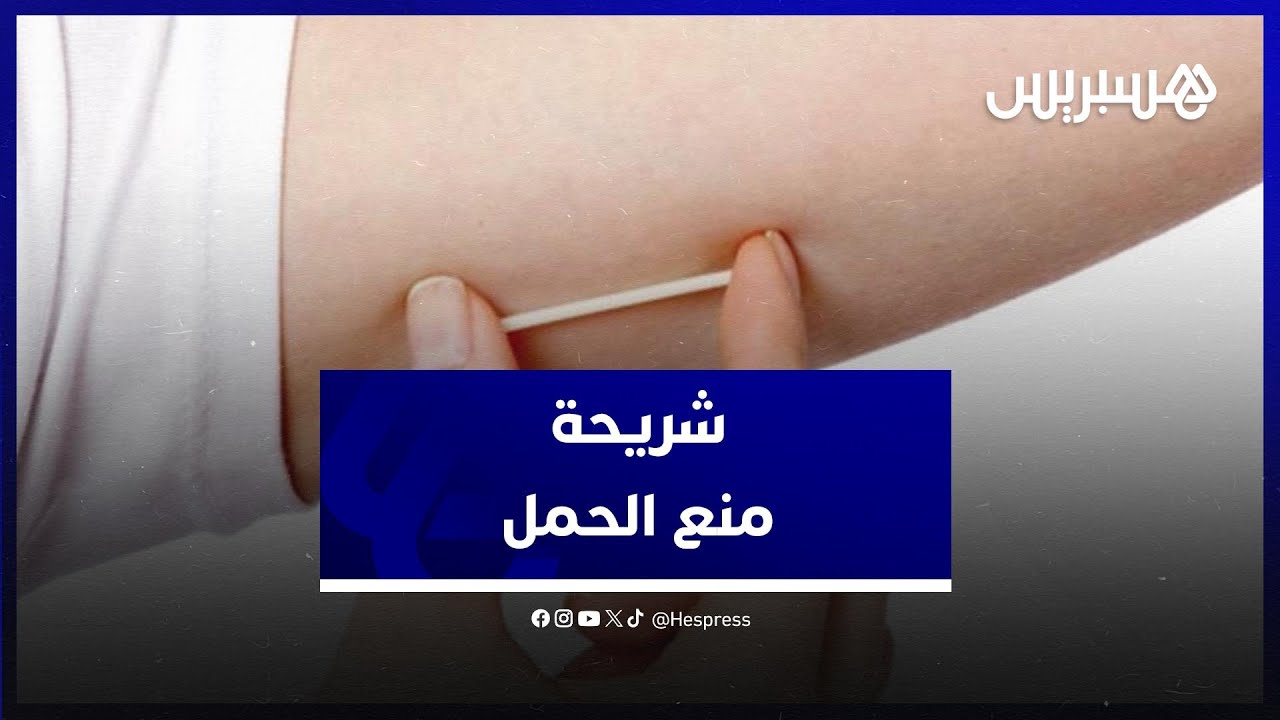 شريحة منع الحمل.. أخصائية توضح مزاياها ومدى فعاليتها وموانع الاستعمال
