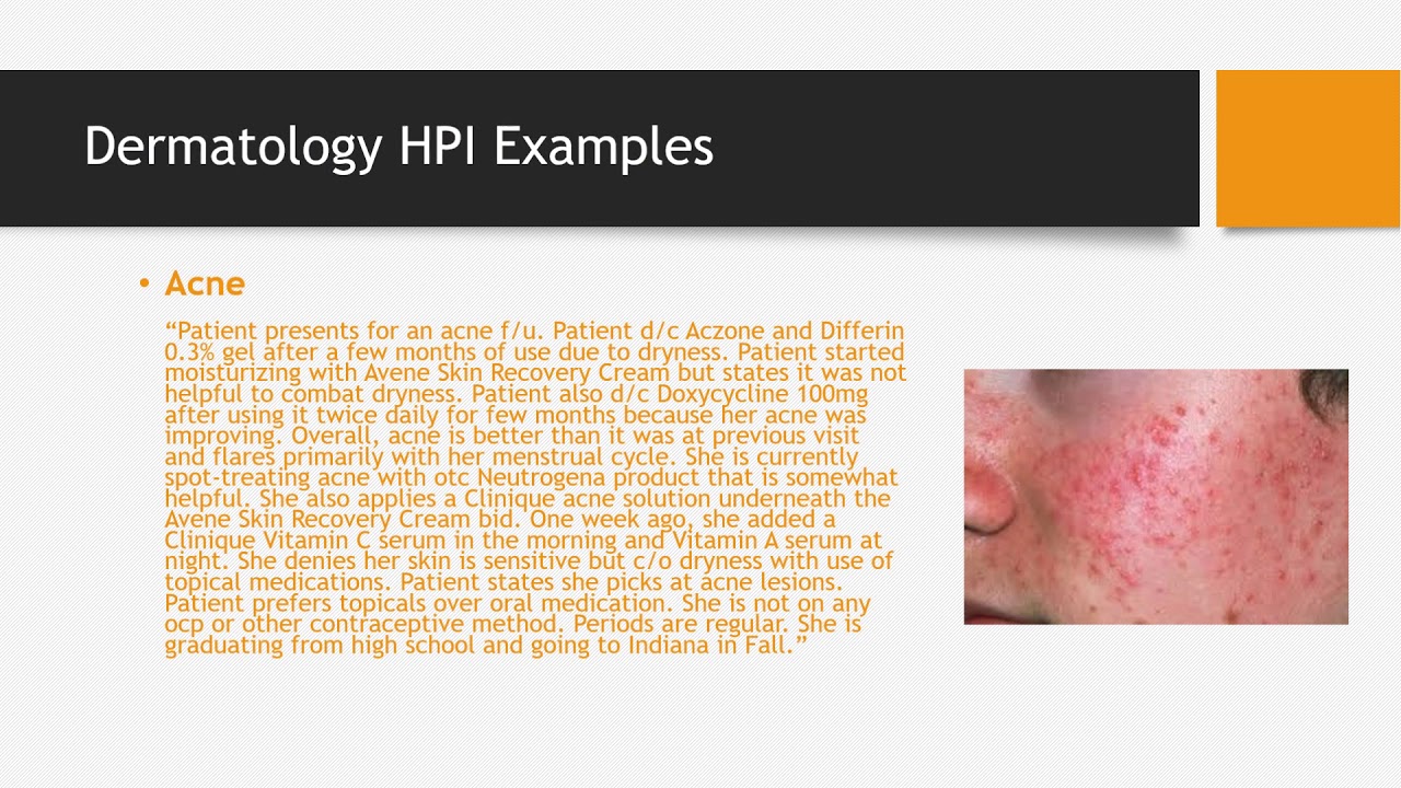 How To Document a Complete History of Present Illness (HPI)