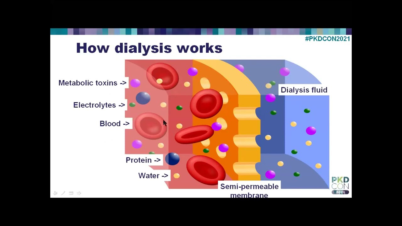 Dialysis 101