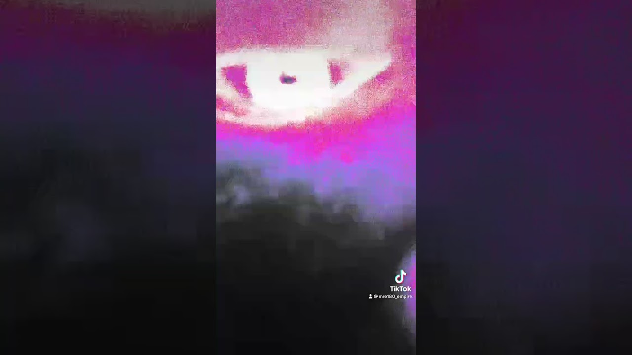 Moving eye. (Don’t watch if you have epilepsy)