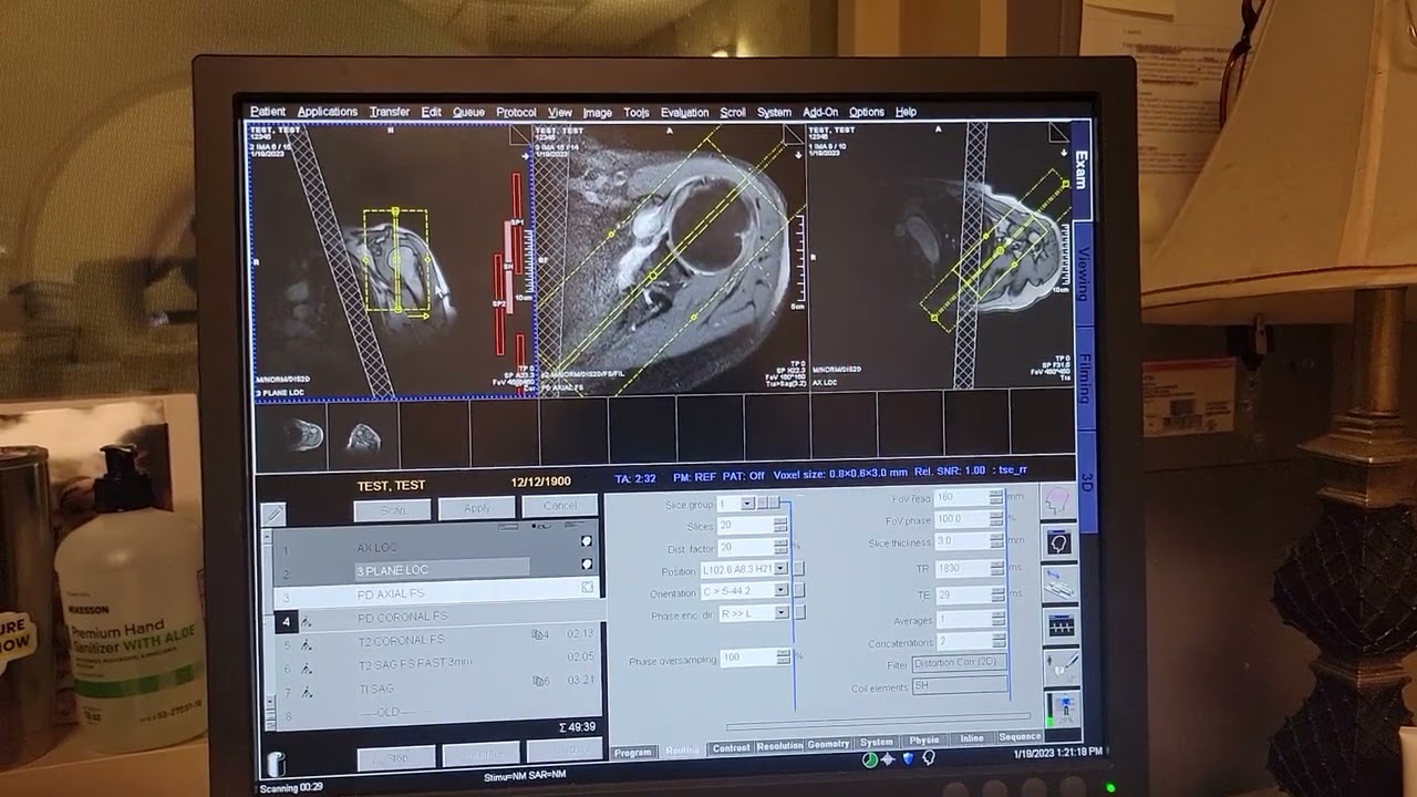 Scanning a shoulder MRI on the Magnetom Espree 1.5T