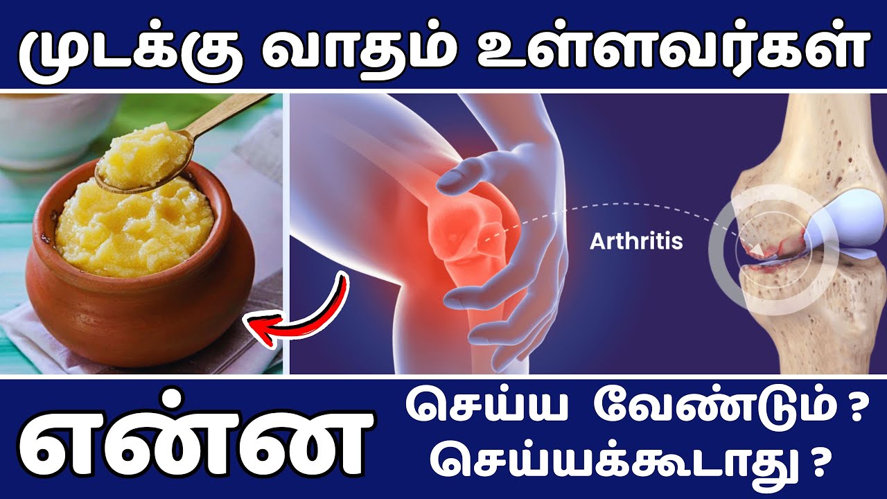 Rheumatoid Arthritis Diet | முடக்கு வாதம் குறைய உதவும் உணவுகள் | Foods in Rheumatoid