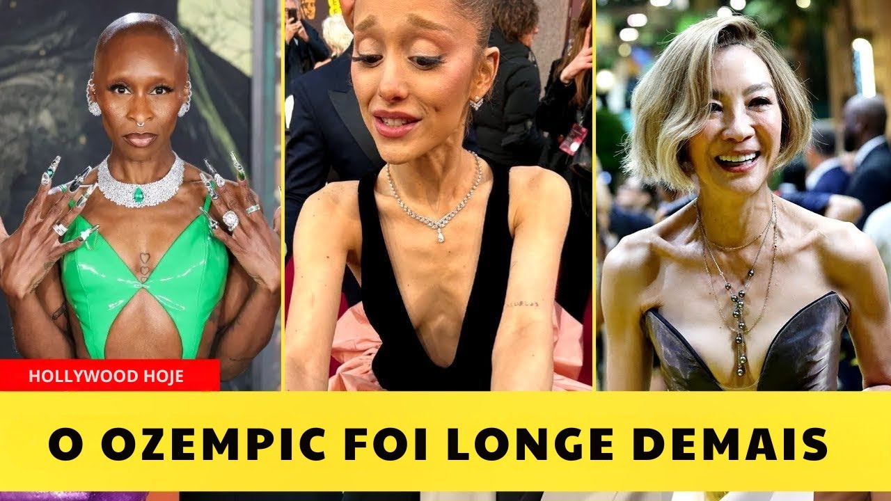 10 Transformações CHOCANTES com Ozempic em Celebridades (2025) | Antes e Depois