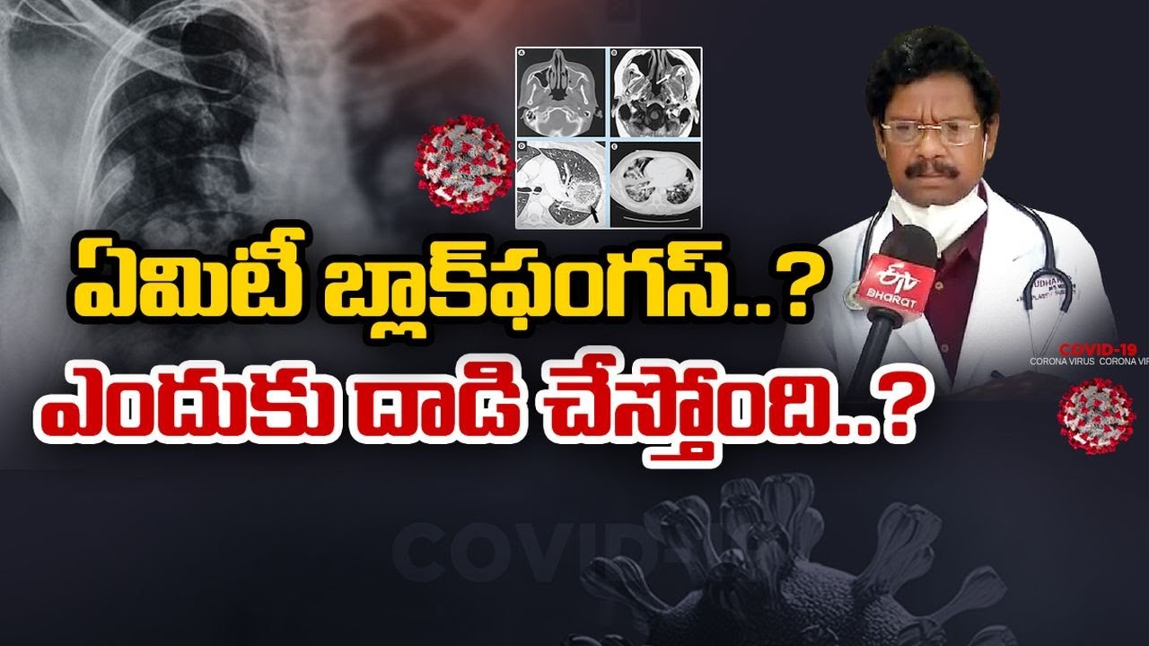 Black Fungus | It's Corona Aftermath | AMC Principal PV Sudhakar || Idi Sangathi