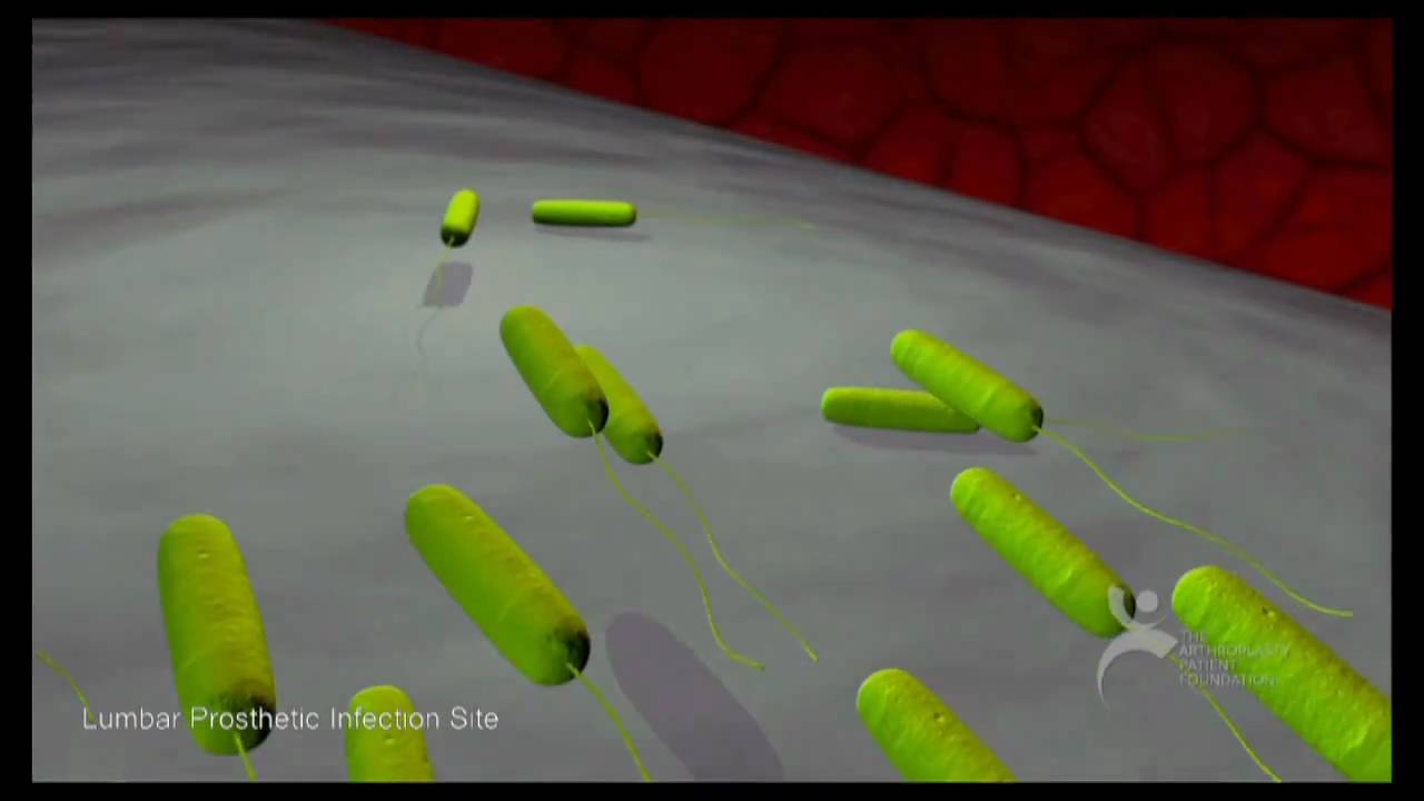 What Are Bacterial Biofilms? A Six Minute Montage