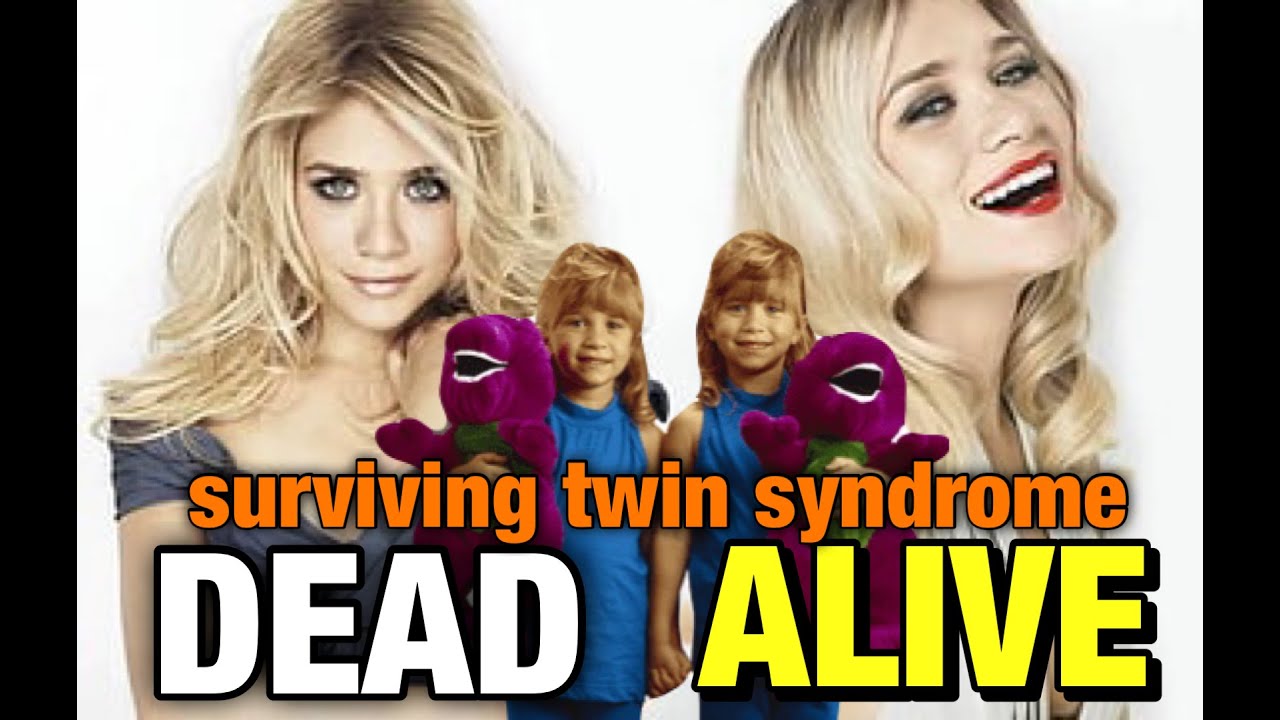 finding out i have surviving twin syndrome? | vanishing twin syndrome